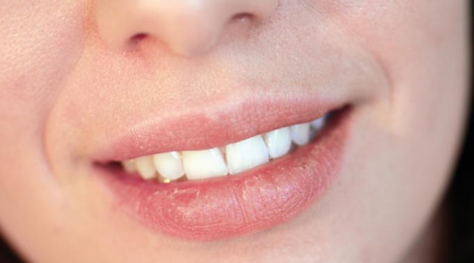 凡士林哪款可以用来擦脸,凡士林正确擦脸方法