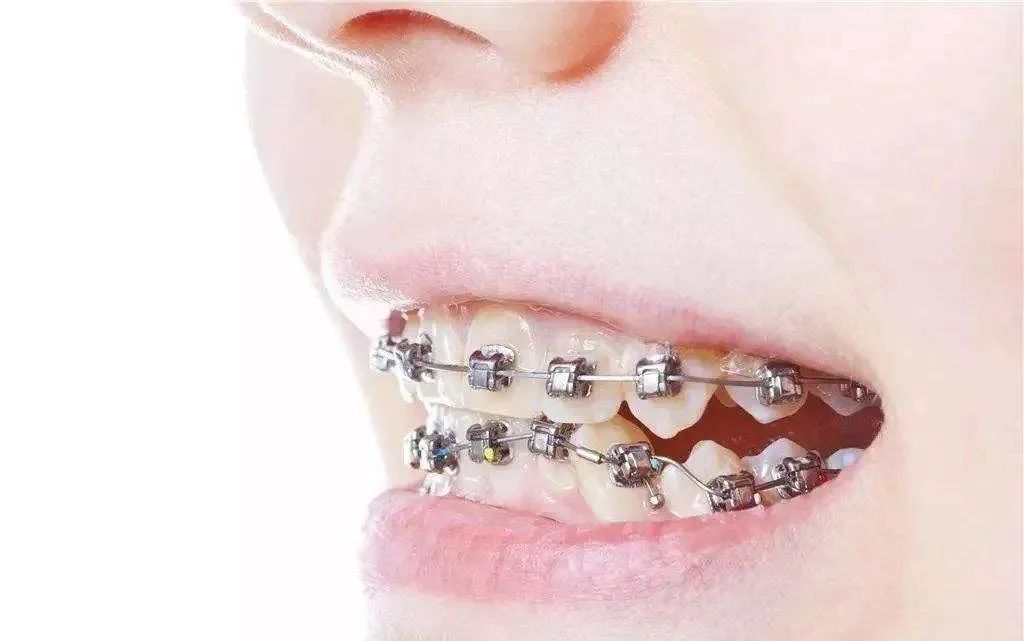 疫情期找不到口腔门诊看牙？这份居家牙病自救指南请查收