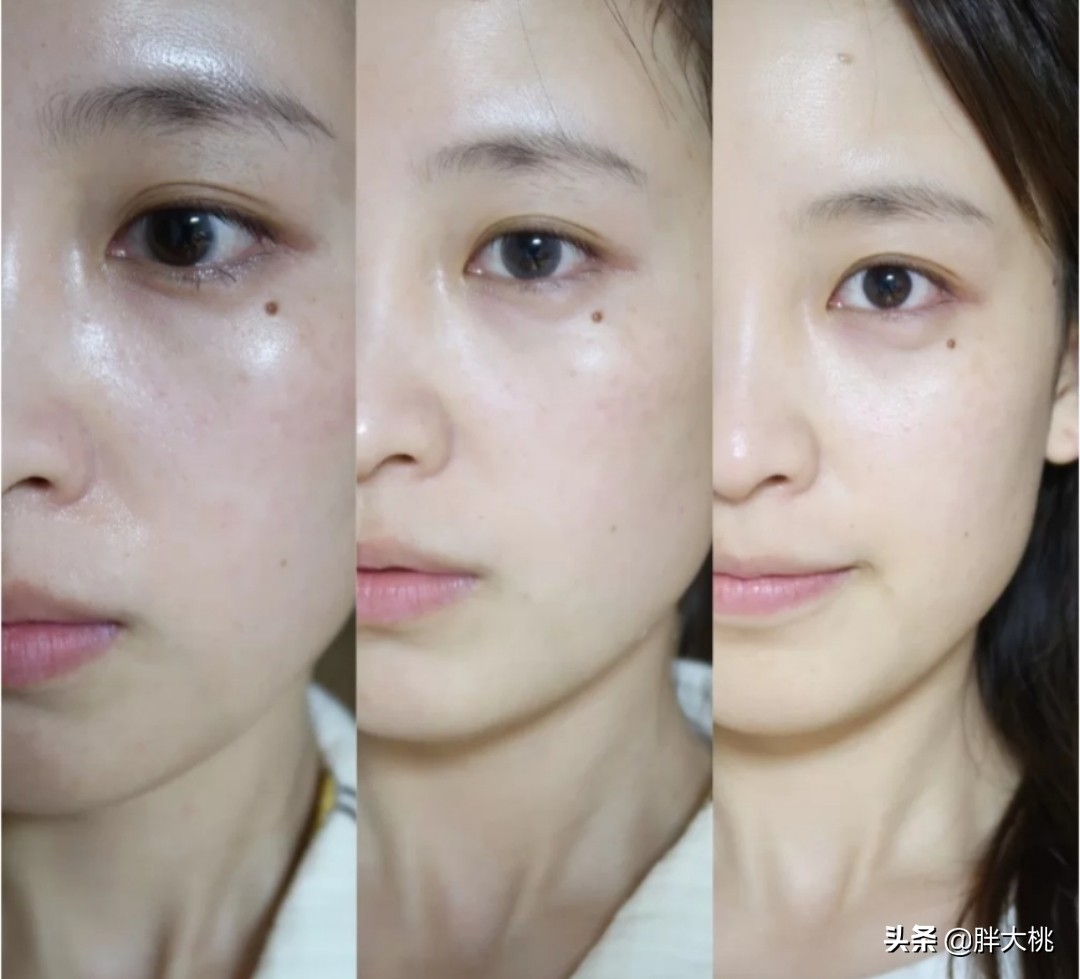 烟酰胺让皮肤变白的原理,烟酰胺对皮肤的作用与危害是什么