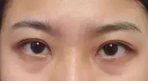 化妆真的能完全遮住瑕疵吗,化妆也掩盖不了岁月的痕迹