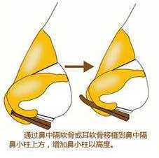 泰剧吹落的树叶主角变性,吹落的树叶泰剧女主变性前的样子