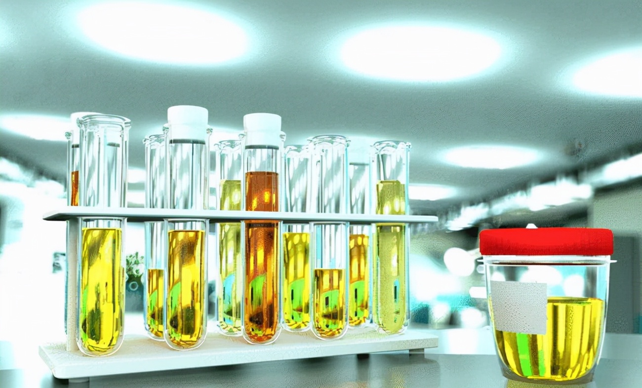 闻尿液能判断怀孕吗,通过尿来判断病