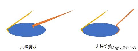 什么手术对白内障最好,老人家最先进的白内障手术过程