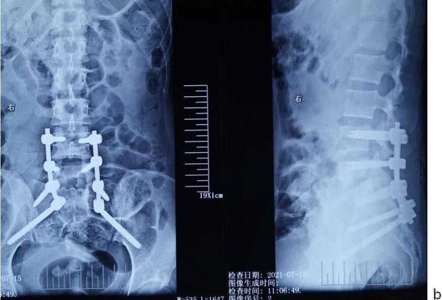 唐都医院脊柱科廖博,脊柱外科医生廖博
