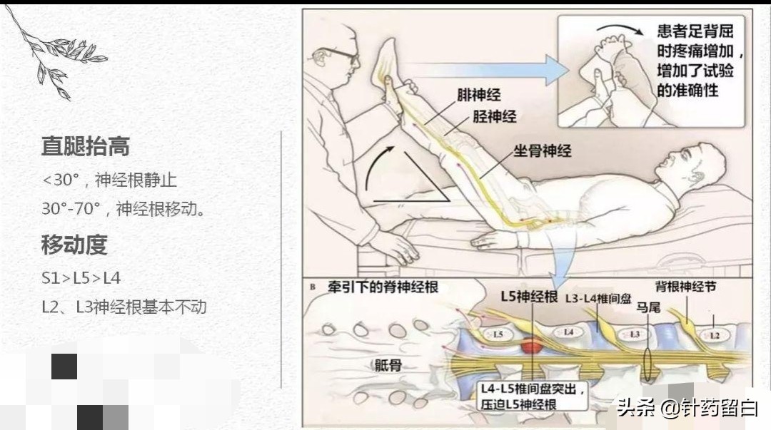 一文读懂靶向治疗,一文看懂椎体成形