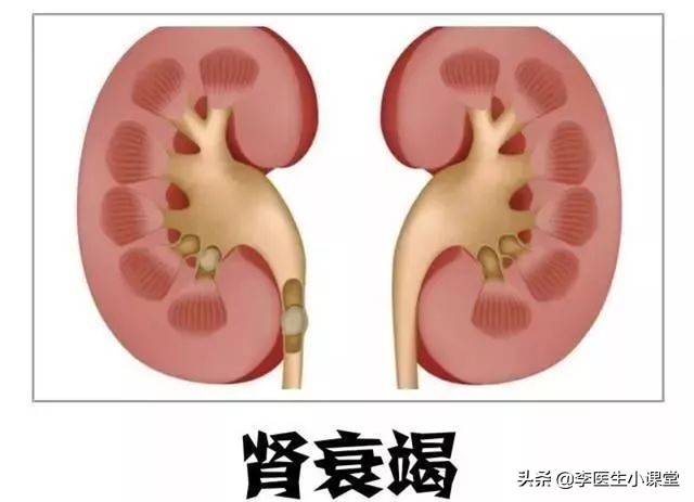 80多岁的老年人缺钙补什么钙好,老年人关节疼痛补什么钙最好