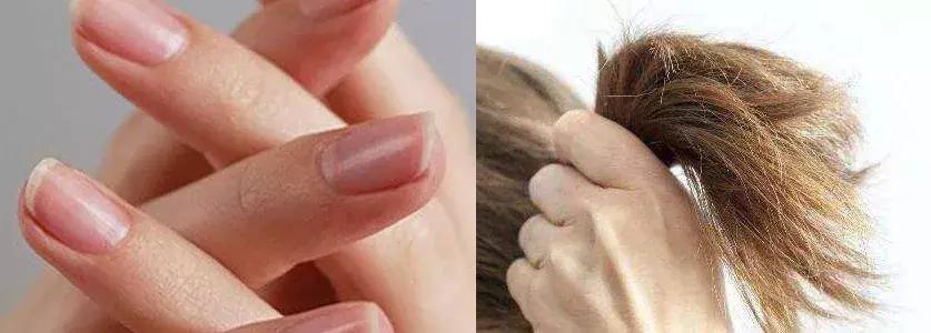 吸黑头神器去粉刺角质收缩毛孔,皮肤清洁收缩毛孔黑头角质