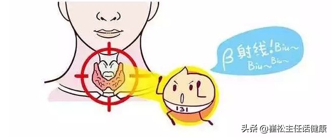 治疗癌症的法宝：放射性治疗