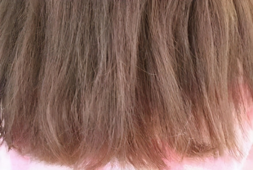 头发变黄后变白发什么原因,不知不觉你却白了头