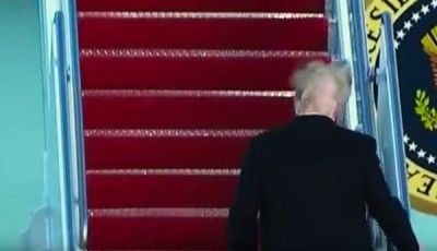 90后没有发际线,90后00后如何不脱发