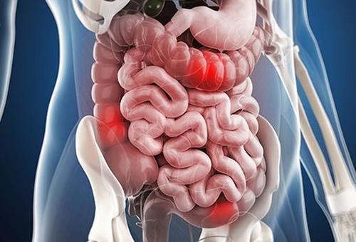 中医各种不同类型便秘的辨证要点,长期便秘怎么办中医推荐14个偏方