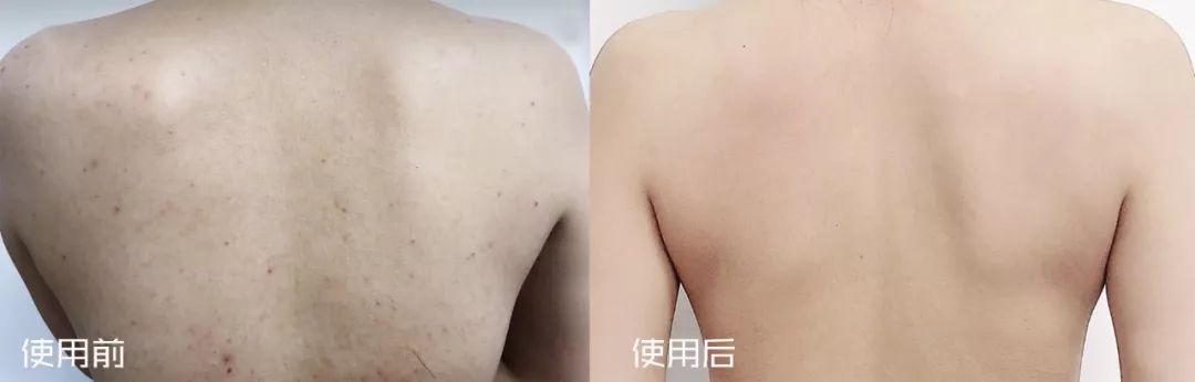 张韶涵如何抗糖,张韶涵抗老秘密