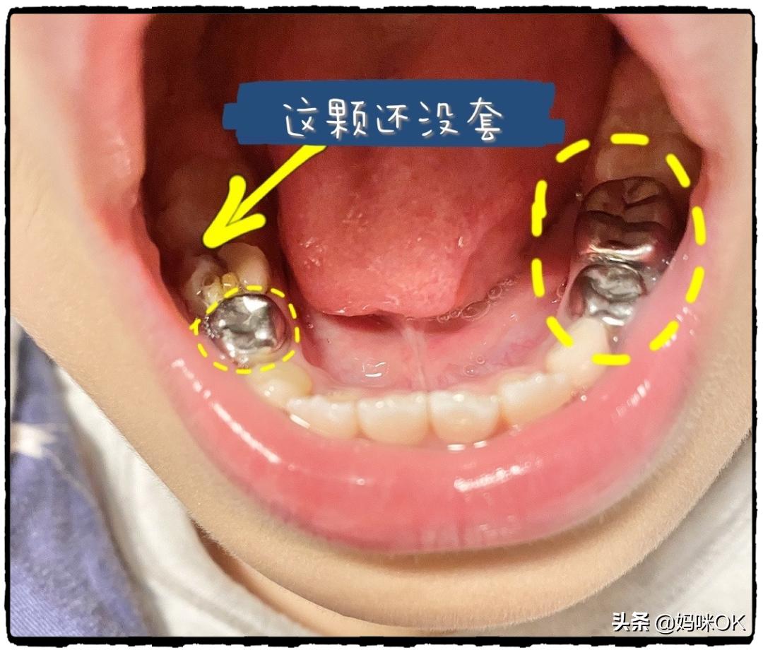 鐑ч挶鏁欒偛鐨勫悗閬楃棁,鑺遍挶鍚庤嚜璐ｈ寰楁氮璐归挶