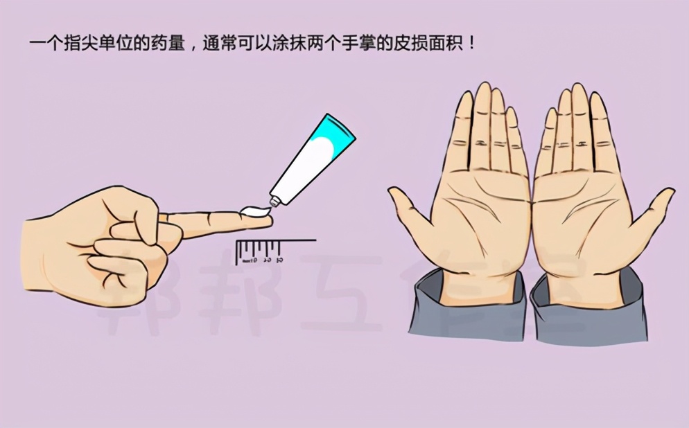 皮炎湿疹瘙痒跟肺有关系吗,皮肤痒各种皮炎湿疹