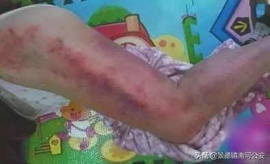 “拍死”6岁男孩！红极一时的“神医”被判刑！