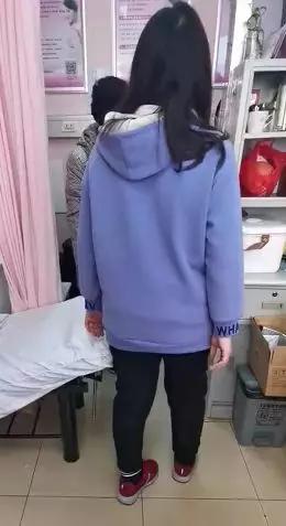 孕期耻骨分离产后怎么恢复,产后耻骨联合分离恢复最佳时间表