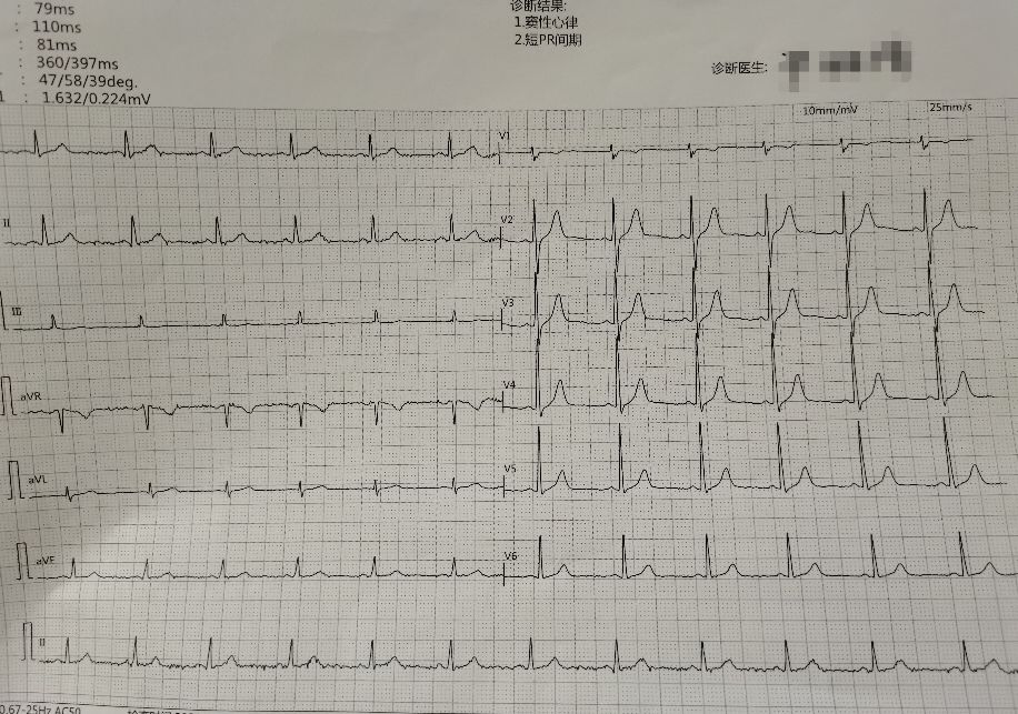 公务员体检基本知识,公务员调动体检需要注意什么