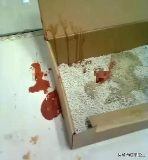 猫咪软便和拉稀的区别是什么,猫咪软便拉稀是如何处理