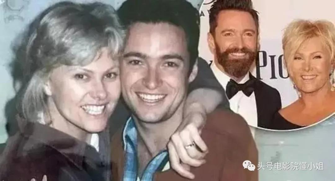 金刚狼爆皮肤癌危机！53岁休杰克曼提醒抹防晒霜，4年前曾动手术