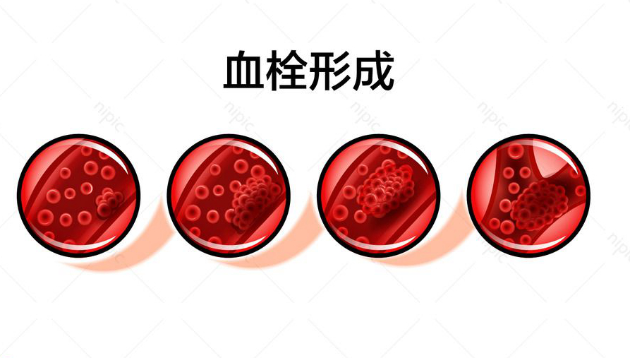 氨甲环酸治疗色斑每次服多少合适,口服氨甲环酸对哪些斑有治疗作用