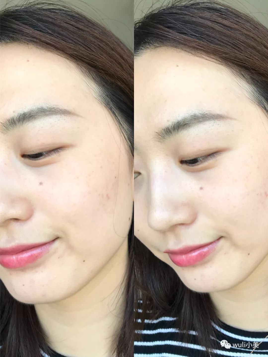 兰蔻磨皮棒购买,兰蔻粉底棒10秒磨皮