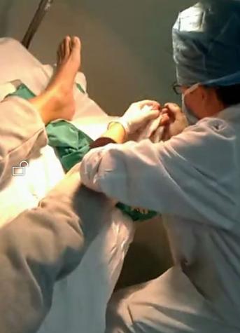 甲沟炎经验分享,甲沟炎的自愈经历