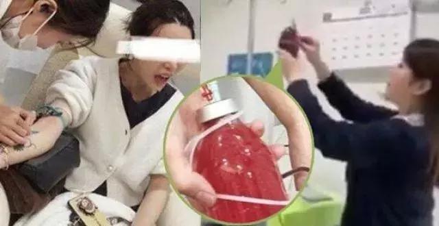 红遍朋友圈的洗血疗法,真能净化血液?背后门道很深…