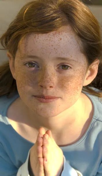 武汉第一医院皮肤科祛斑医生推荐,权威皮肤科专家谈祛斑