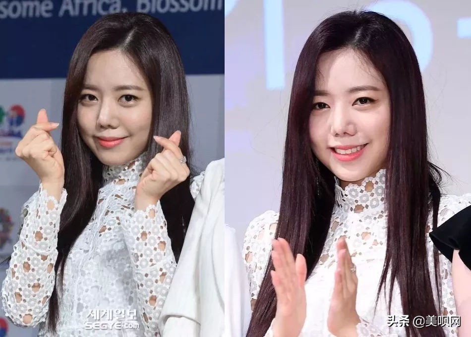 明星都在用的缩小鼻翼神器,明星鼻子做鼻翼缩小外切