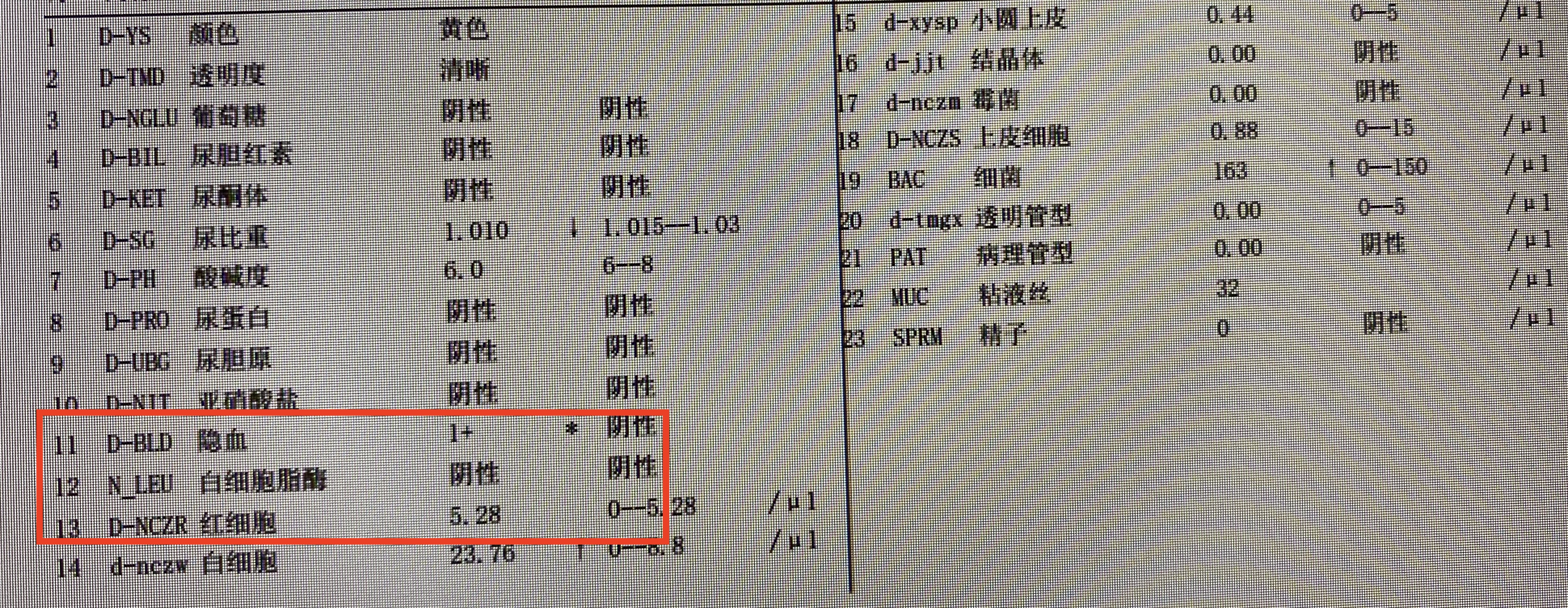 尿隐血3+是不是尿道炎,尿常规隐血3+红细胞高是肾炎么