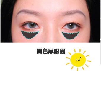 用了很多眼霜还是有黑眼圈？别怪产品太鸡肋，只能说是你没选对