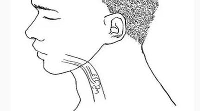 牙疼时钻牙,过年前拔牙齿这是好事还是坏事