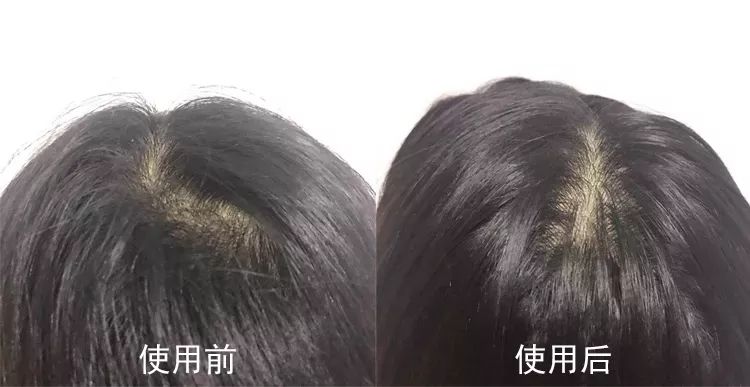 清爽头皮不掉发洗发露,洗发露去屑止痒留香持久干头发