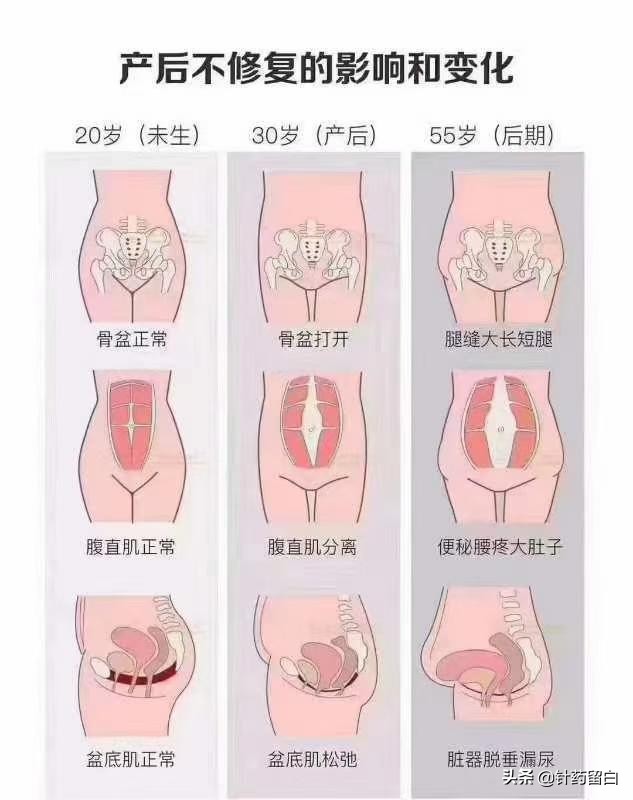 宝妈盆底肌松弛漏尿怎么办,产后七年盆底肌漏尿怎么解决