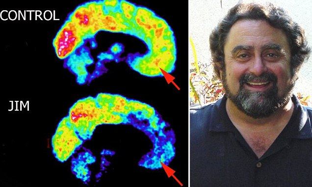 什么是心理变态有哪些表现,心理变态和行为变态有什么区别吗