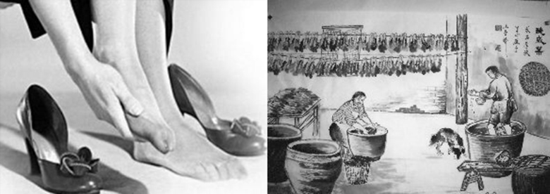 怎么治疗甲沟炎不让往肉里长,快速治疗甲沟炎的小妙招