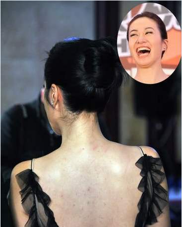 白天身上螨虫多是什么症状,身上螨虫多影响护肤吗