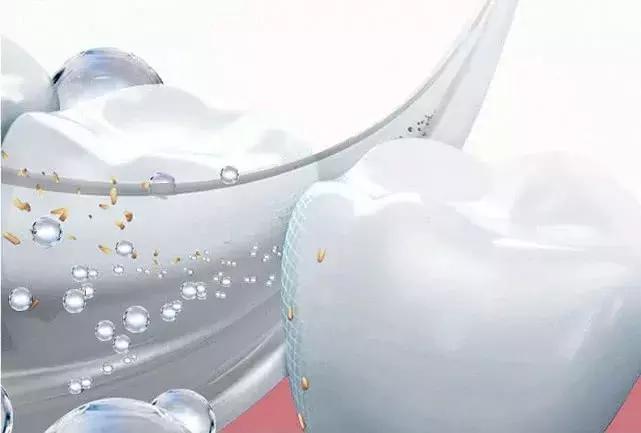 一口黄牙能洗白吗,一口黄牙毁了一张脸