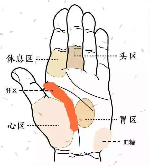 手掌有的地方发黄是不是肝有问题,手掌周围一圈黑是什么原因
