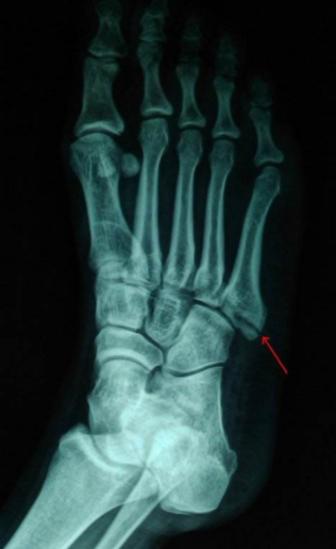 林书豪的伤病,林书豪重返赛场再次负伤