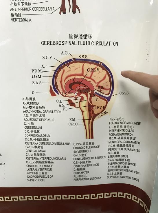广西南宁一女子砍猪骨后发烧40度,砍猪骨头的刀砍到手会得破伤风吗