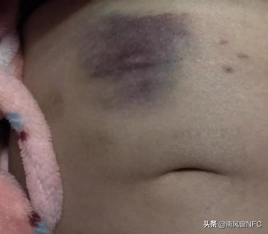 与疫情赛跑的孕妇,与疫情赛跑需要争分夺秒