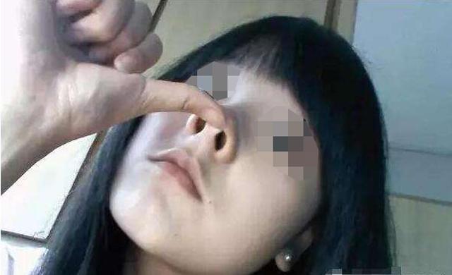 100个最关心的问题,隆鼻的十大问答