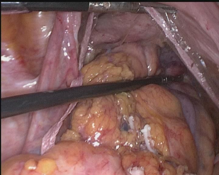 娓崡甯傜浜屽尰闄㈣偪鐦よ兏澶栫,鑲跨槫鍖婚櫌鑳镐簩澶栫