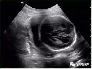 产科常规彩色超声报告单介绍,常见妇科疾病超声报告