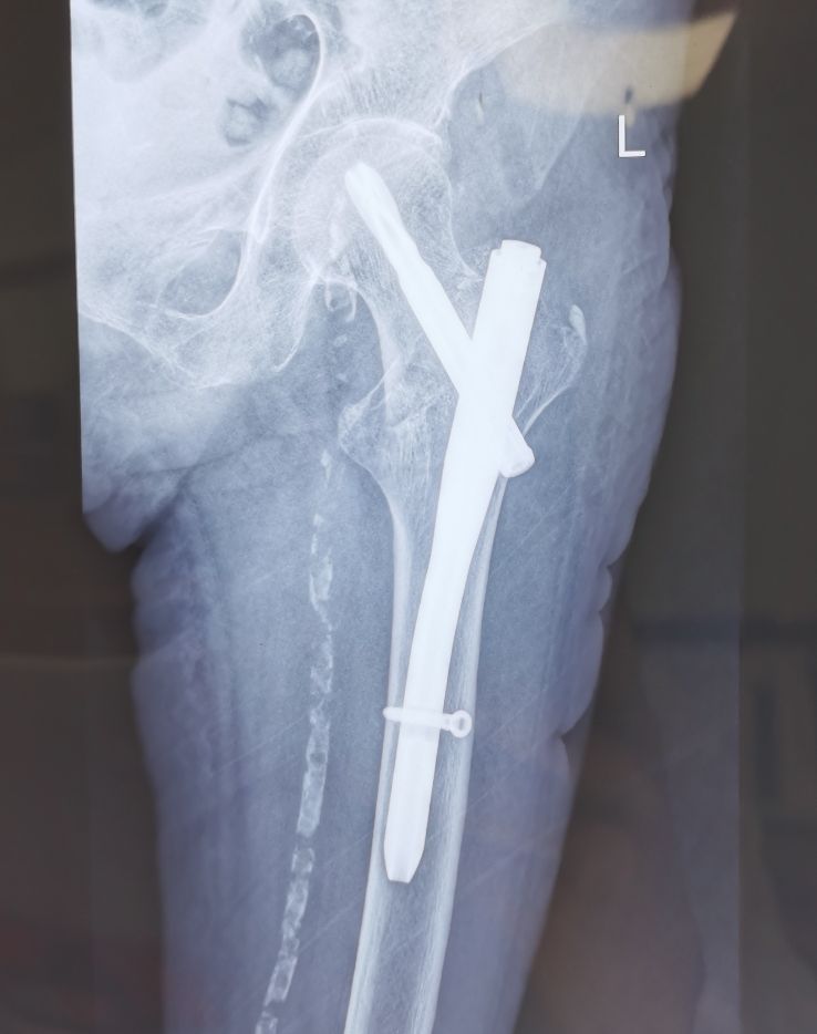 病例分享:不论什么疾病,只要有功能问题,就需要规范化康复治疗