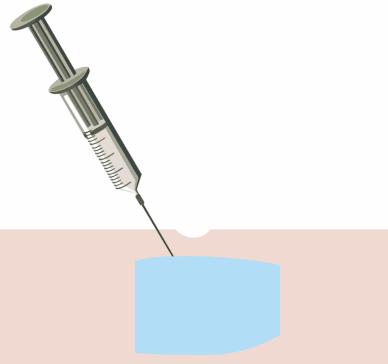 有法令纹特显老教你几招抚平细纹,法令纹这么显老得如何搞定