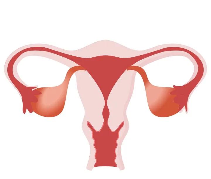 宫腔积液会致不孕?中西结合治疗显威力