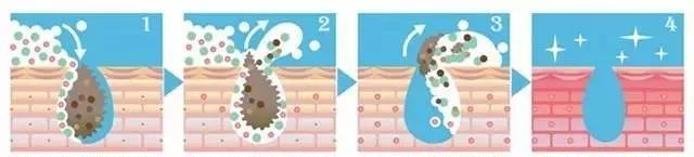 夏天肤色黑怎么办,黑黄暗沉肤色改善