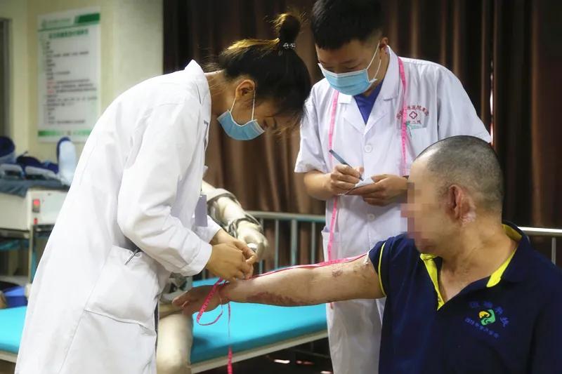 江苏省人民医院烧伤康复中心,医院烧伤康复患者